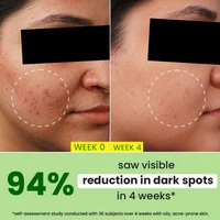 Dot & Key 10% Niacinamide Cica Spot Reduction Face Serum ,20ml 