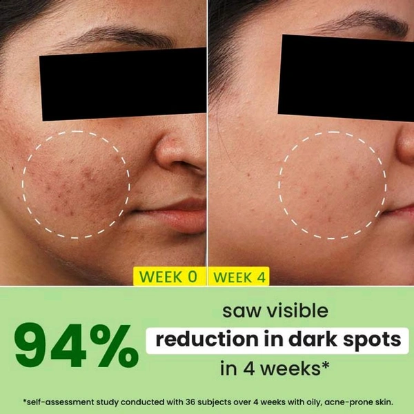 Dot & Key 10% Niacinamide Cica Spot Reduction Face Serum ,20ml 