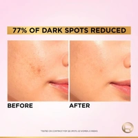 Loreal Paris Glycolic Bright 8% Face Serum ,30 ml 