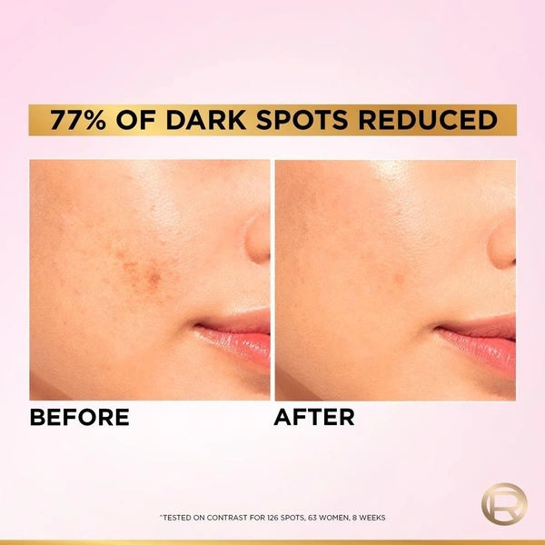 Loreal Paris Glycolic Bright 8% Face Serum ,30 ml 