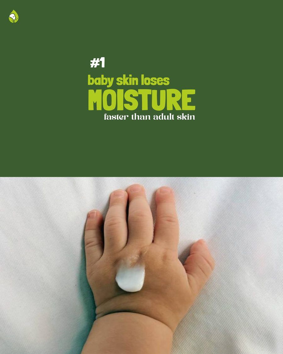 Baby skin loses moisture faster than adult skin