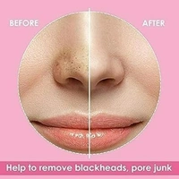 Charcoal Nose Pore Strips for Blackhead Removal