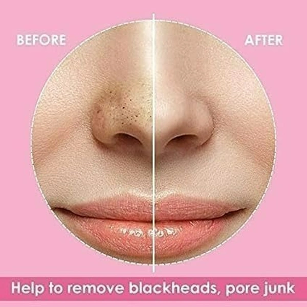Charcoal Nose Pore Strips for Blackhead Removal