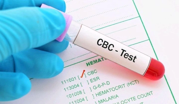 Complete Blood Count (CBC Test)