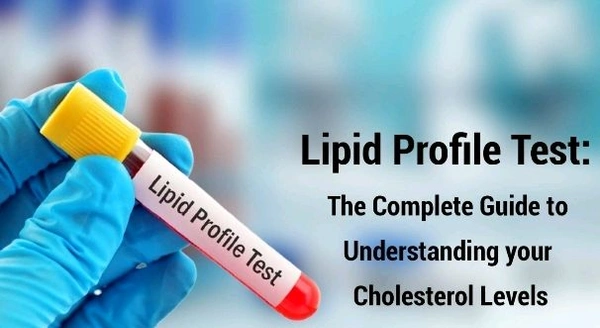 Lipid Profile Test ( Cholesterol)