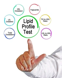 Lipid Profile Test ( Cholesterol)