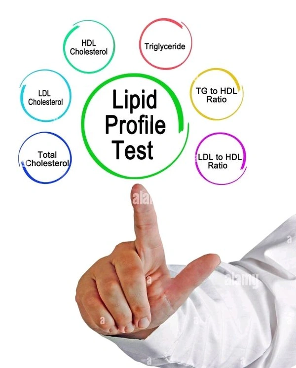 Lipid Profile Test ( Cholesterol)