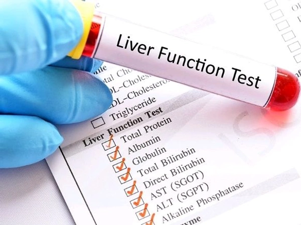 Liver Function Test ( LFT)