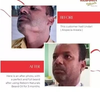 Reborn Naturals BEARDOIL 3IN1 Hair Oil (100 ml) - 100 ml