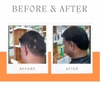 Reborn Naturals BEARDOIL 3IN1 Hair Oil (100 ml) - 100 ml