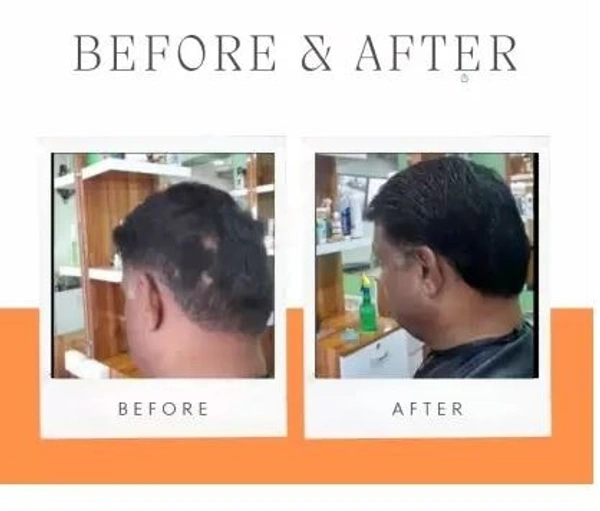 Reborn Naturals BEARDOIL 3IN1 Hair Oil (100 ml) - 100 ml