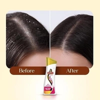 MEERA SHAMPOO SMALL ONION FENUGREEEK SHAMPOO