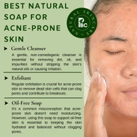 ANTI ACNE SOAP - 100g